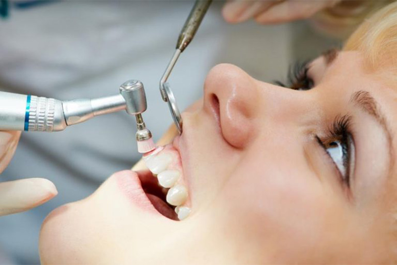 Dental Cleanings and Exams in High Point