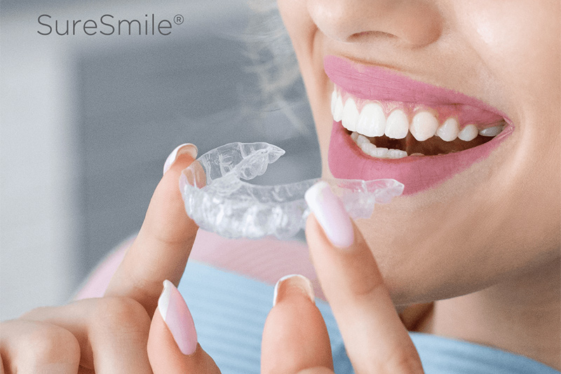 SureSmile® Clear Aligners in High Point