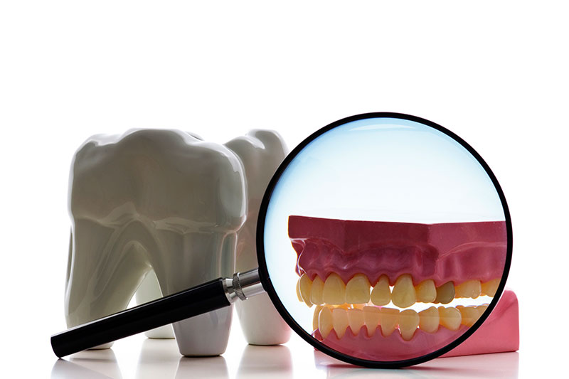 Root Canal Treatment in High Point